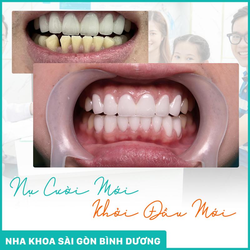 Nha khoa Sài Gòn Bình Dương