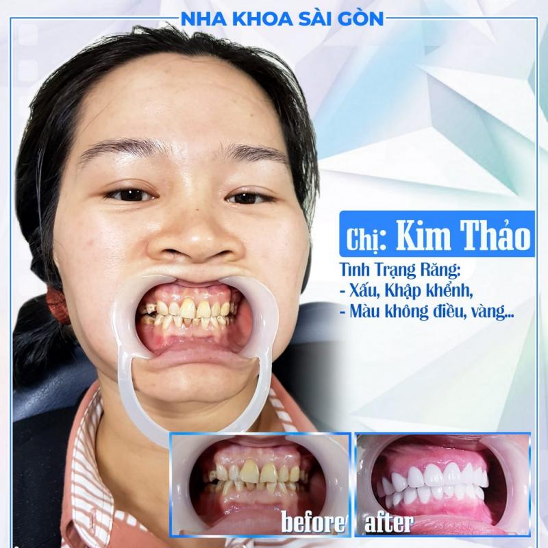 Nha khoa Sài Gòn