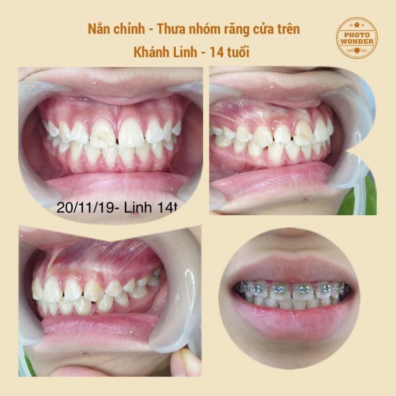 Nha khoa Sài Gòn Hải Phòng