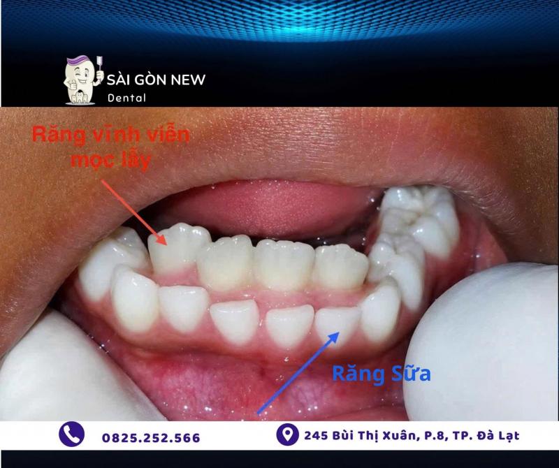Nha khoa Sài Gòn New