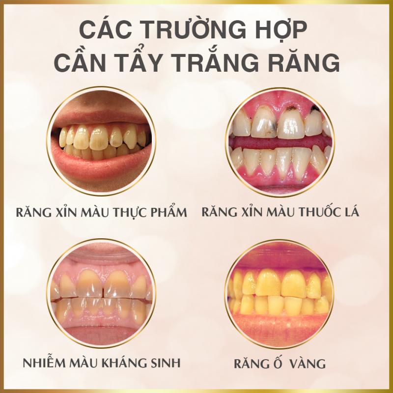 Nha Khoa Sài Gòn Quốc Tế