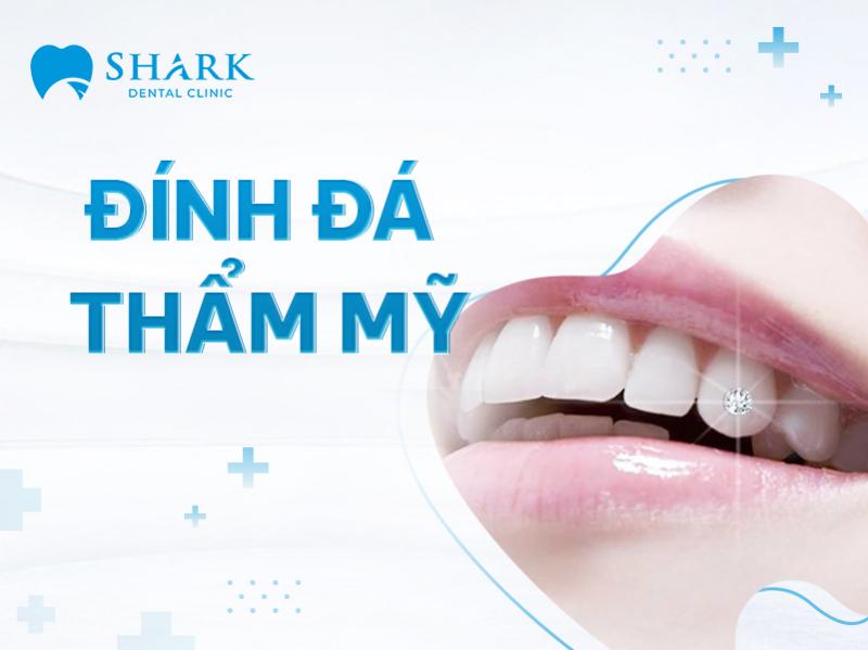 Nha Khoa Shark