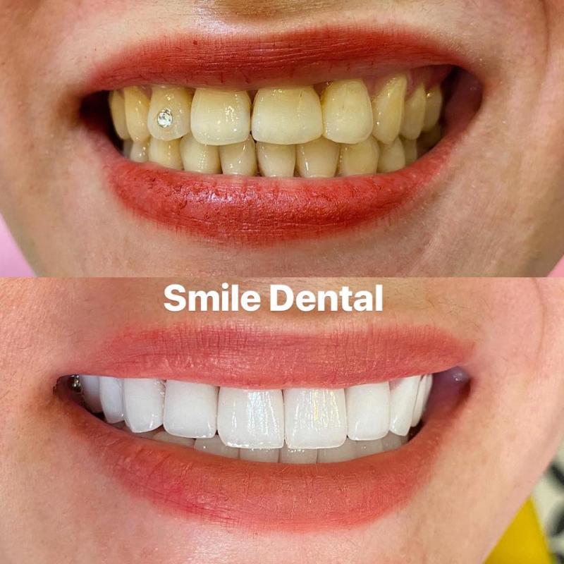 Nha Khoa Smile Dental