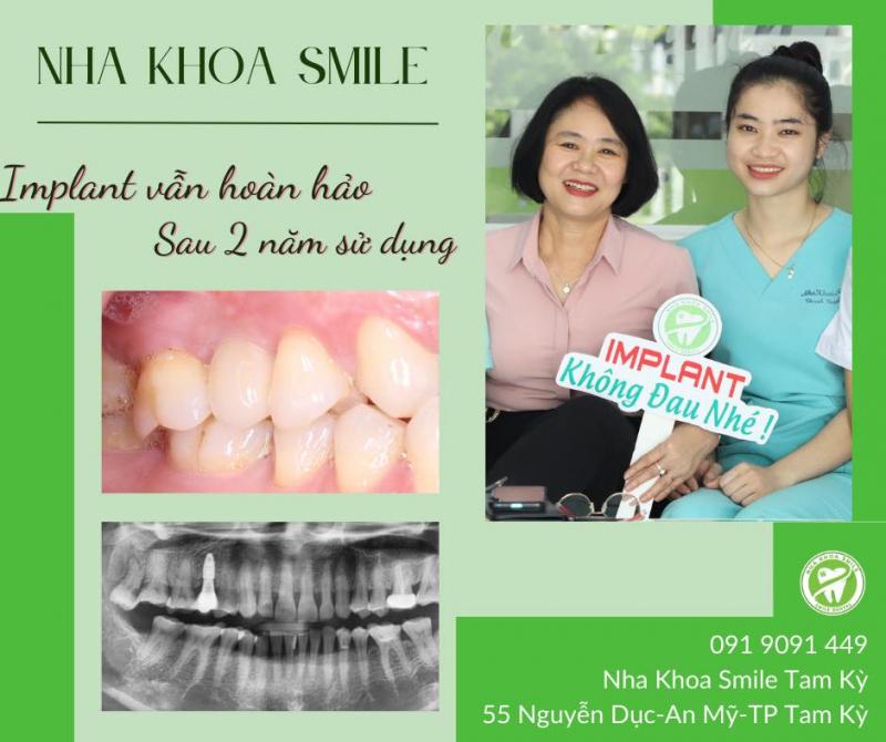 Nha Khoa Smile Tam Kỳ