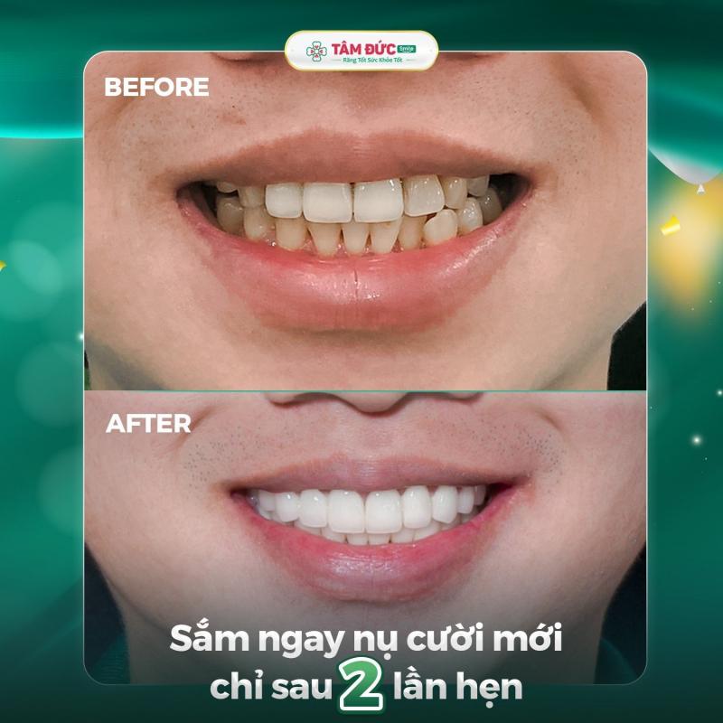 Trung tâm Nha khoa Tâm Đức Smile