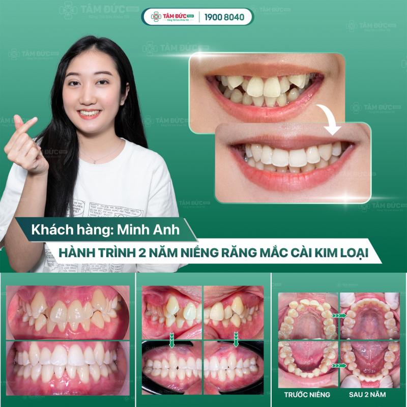 Nha Khoa Tâm Đức Smile