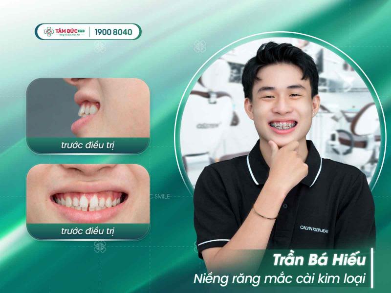 Trung tâm Nha khoa Tâm Đức Smile