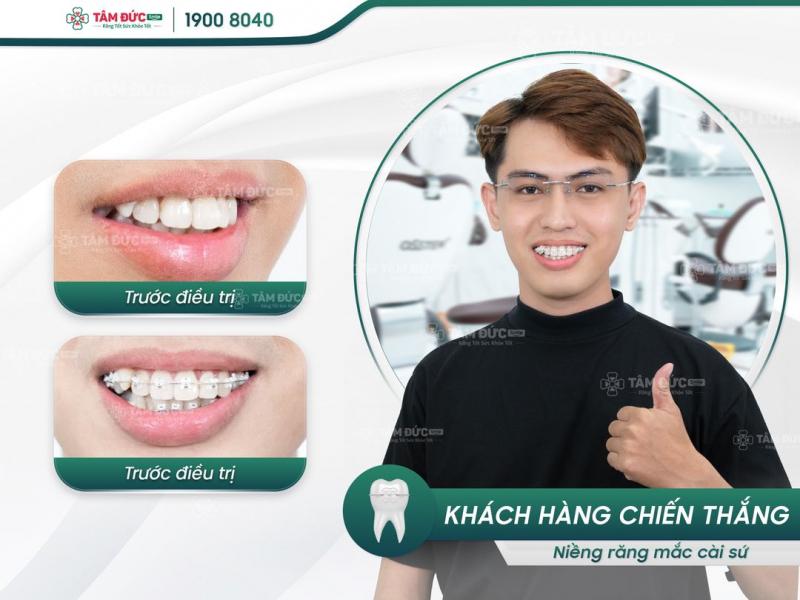 Nha Khoa Tâm Đức Smile