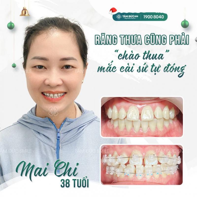 Nha Khoa Tâm Đức Smile