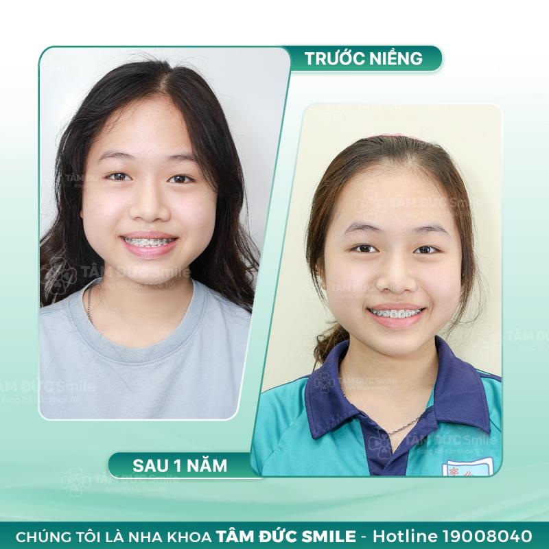 Nha Khoa Tâm Đức Smile