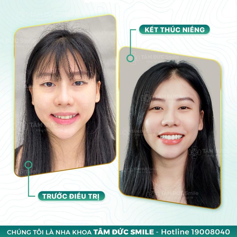 Nha Khoa Tâm Đức Smile