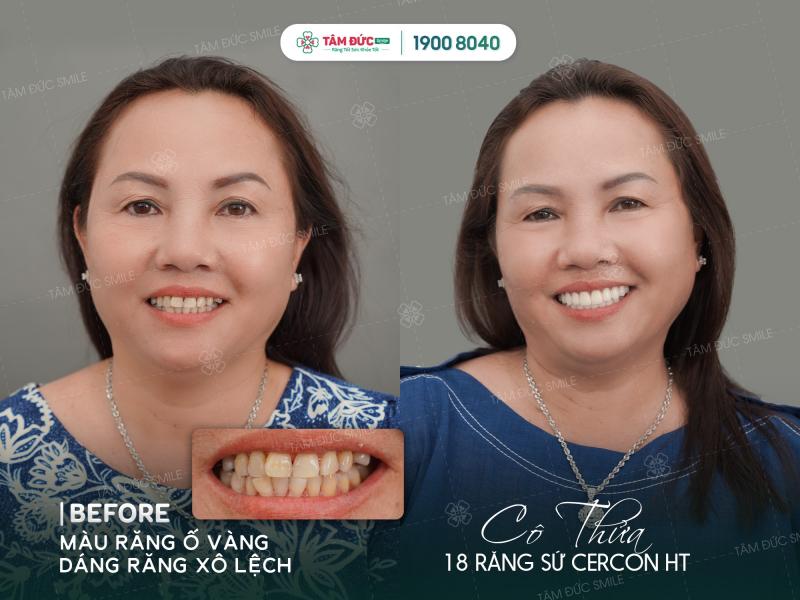 Nha Khoa Tâm Đức Smile