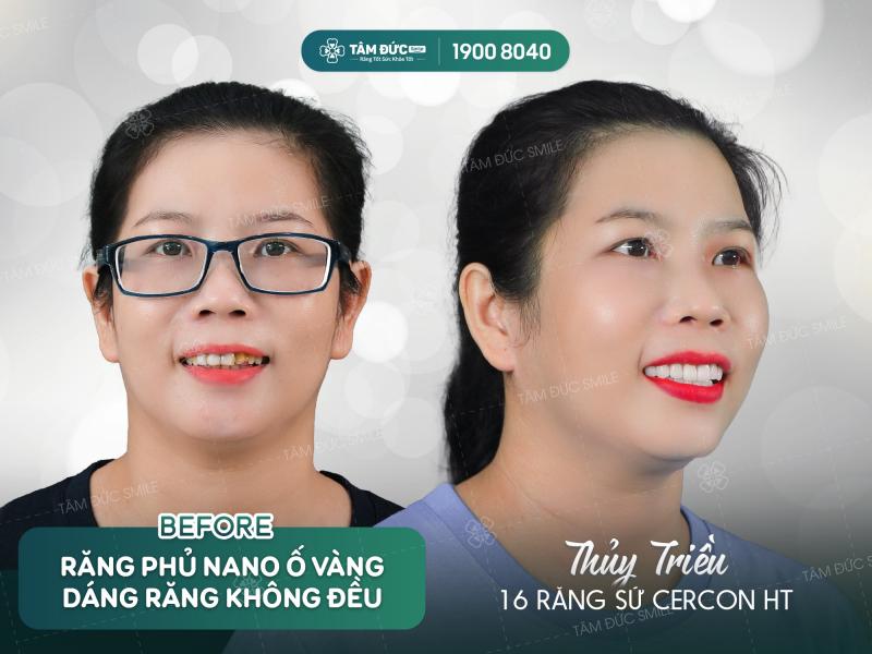 Nha Khoa Tâm Đức Smile