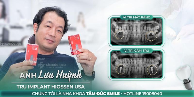 Nha Khoa Tâm Đức Smile Tây Ninh