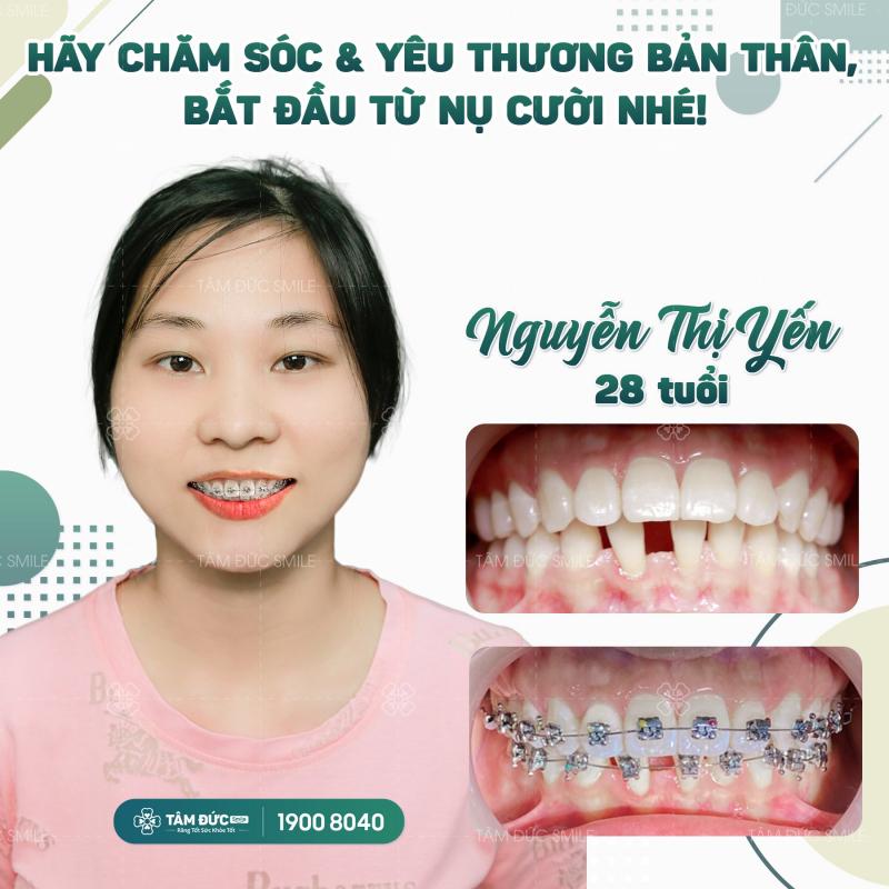 Nha khoa Tâm Đức Smile Vũng Tàu