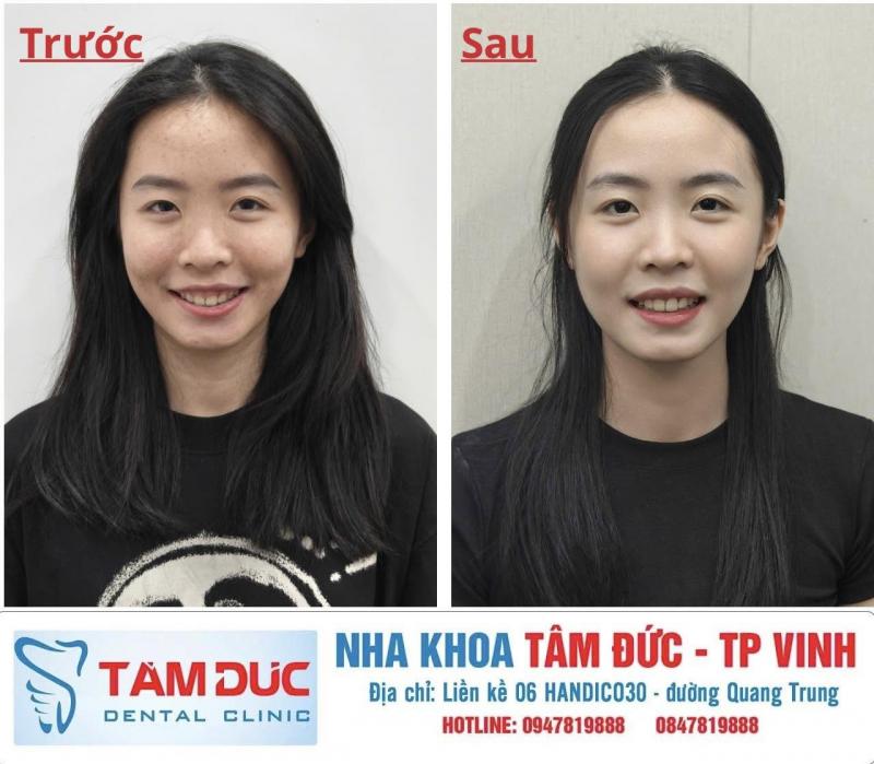 Nha Khoa Tâm Đức