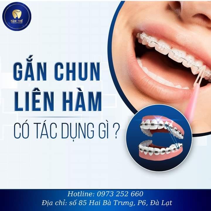 Nha Khoa Tâm Thế Đà Lạt