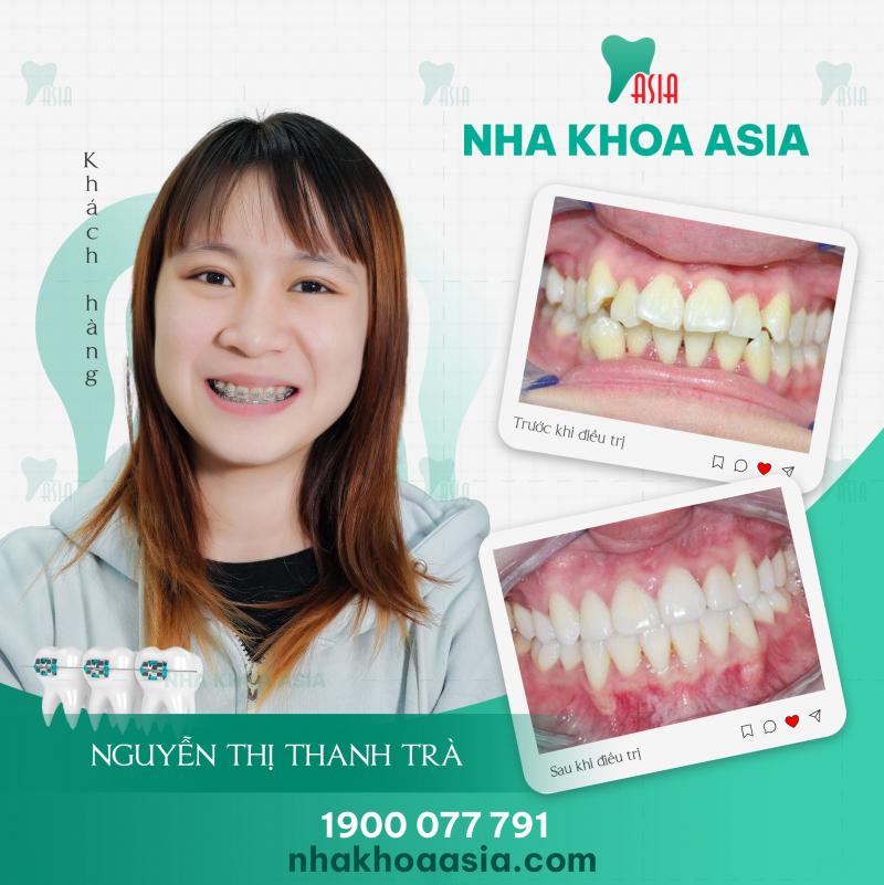 Nha khoa Thẩm mỹ Asia