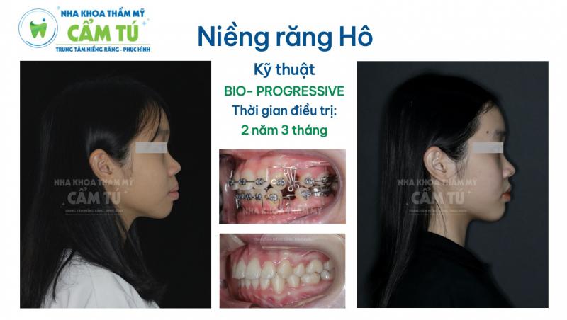 Nha Khoa Thẩm Mỹ Cẩm Tú