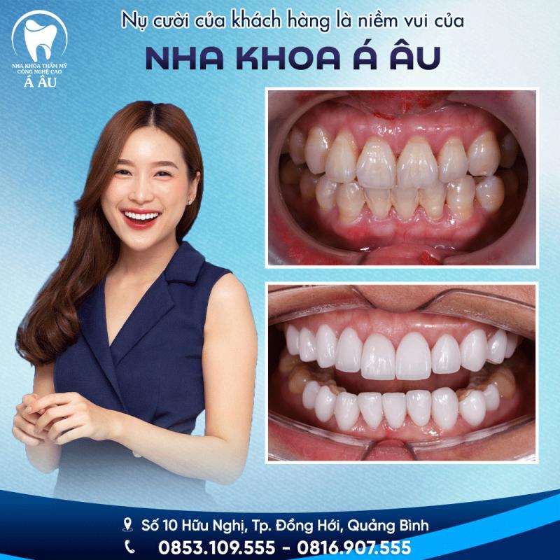 Nha khoa Thẩm mỹ công nghệ cao Á - Âu