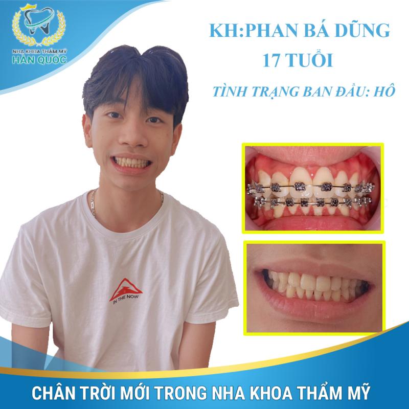 Nha khoa Thẩm mỹ Hàn Quốc