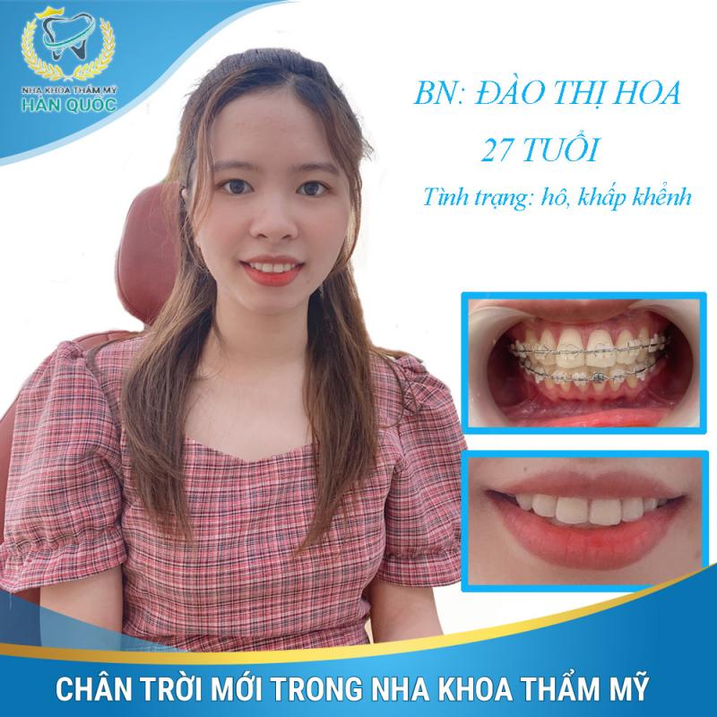 Nha khoa Thẩm mỹ Hàn Quốc