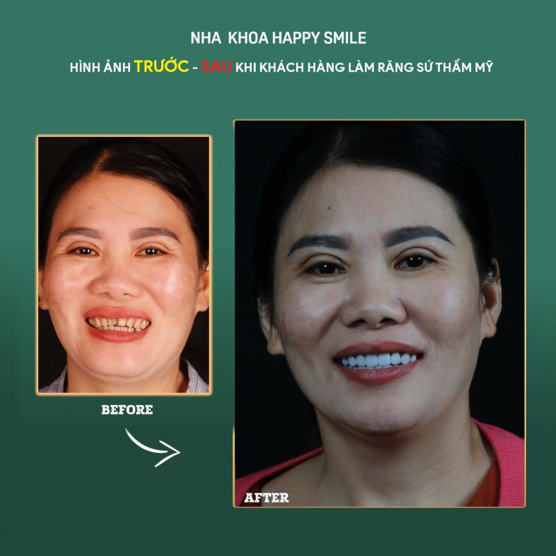 Nha khoa thẩm mỹ HAPPY SMILE