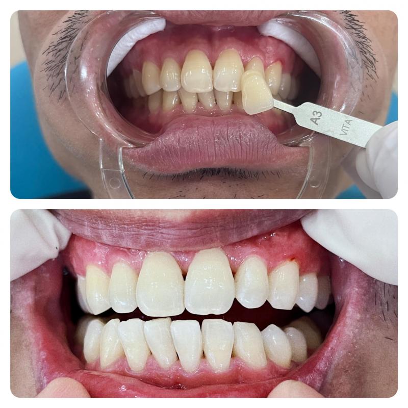 Nha khoa Thẩm Mỹ HT - SMILE