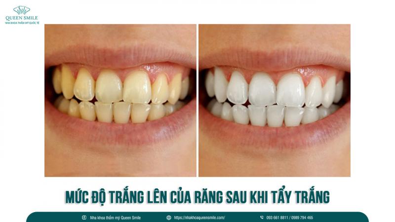 Nha khoa Thẩm mỹ Queen Smile