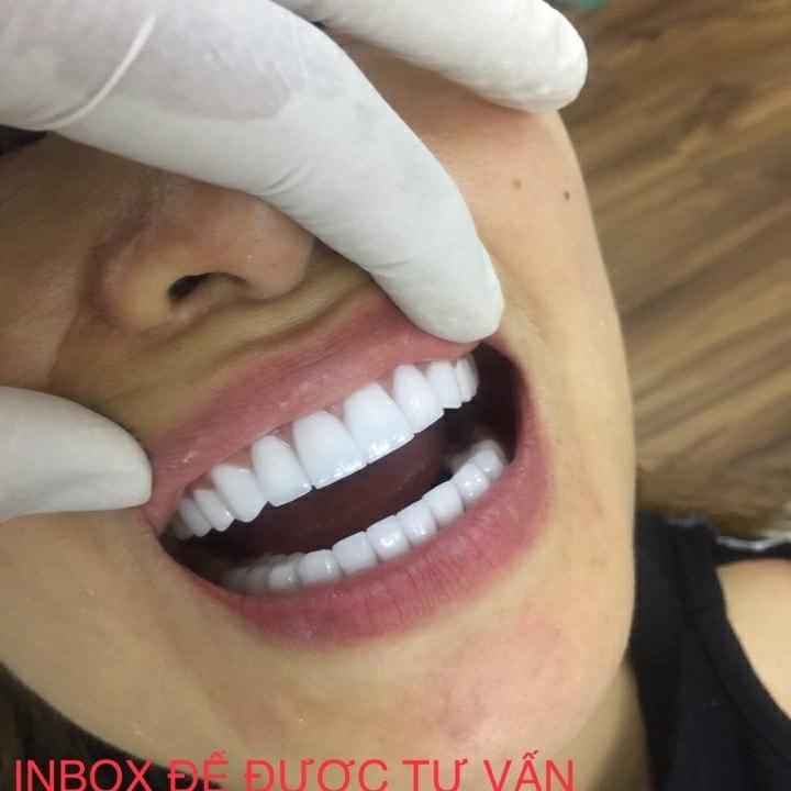 Nha Khoa Thẩm Mỹ Quốc Tế City Dental