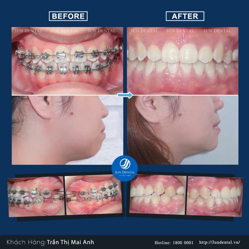 Nha khoa thẩm mỹ Jun Dental