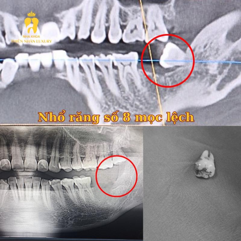 Nha Khoa Thẩm Mỹ Quốc Tế Thiện Nhân