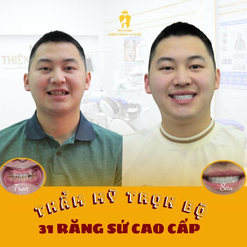 Nha Khoa Thẩm Mỹ Quốc Tế Thiện Nhân Lào Cai