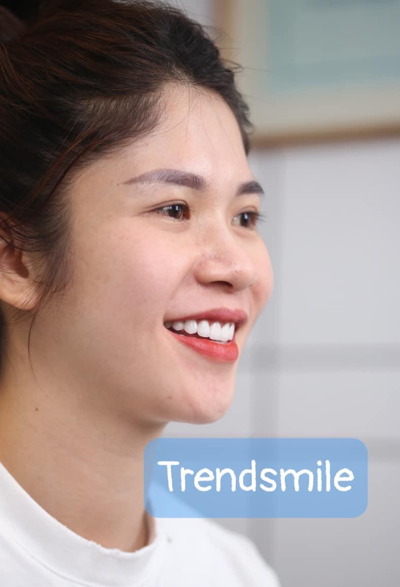 Nha khoa Thẩm mỹ Quốc tế Trendsmile