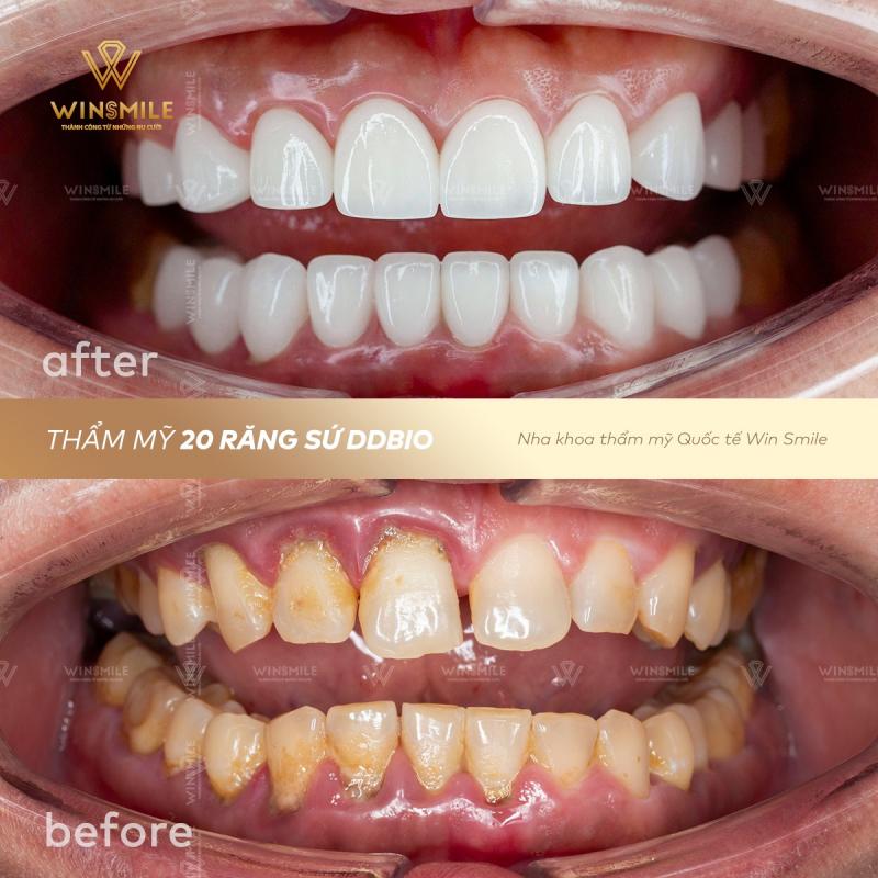 Nha Khoa Thẩm Mỹ Quốc Tế Win Smile