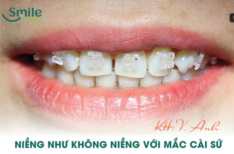 Nha Khoa Thẩm Mỹ Smile