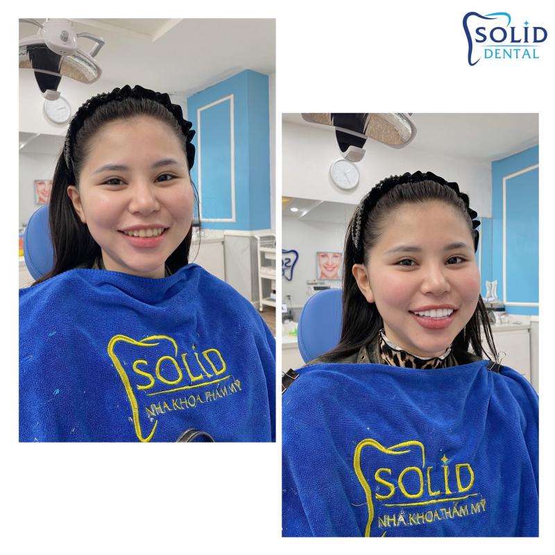 Nha Khoa Thẩm Mỹ SOLID