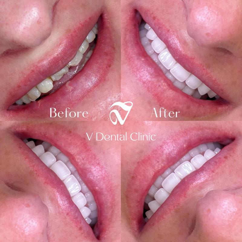 Nha Khoa Thẩm Mỹ V - V Dental Clinic