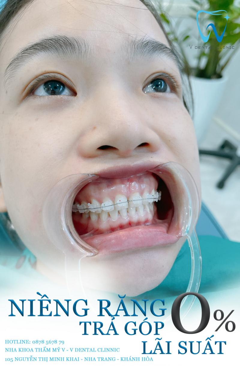 Nha Khoa Thẩm Mỹ V - V Dental Clinic