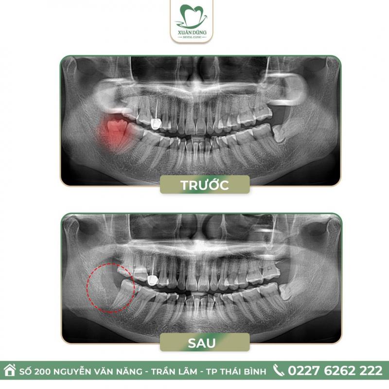 Nha Khoa Thẩm Mỹ Xuân Dũng