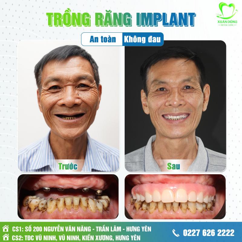 Nha Khoa Thẩm Mỹ Xuân Dũng