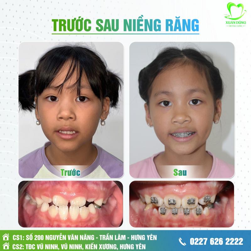 Nha Khoa Thẩm Mỹ Xuân Dũng