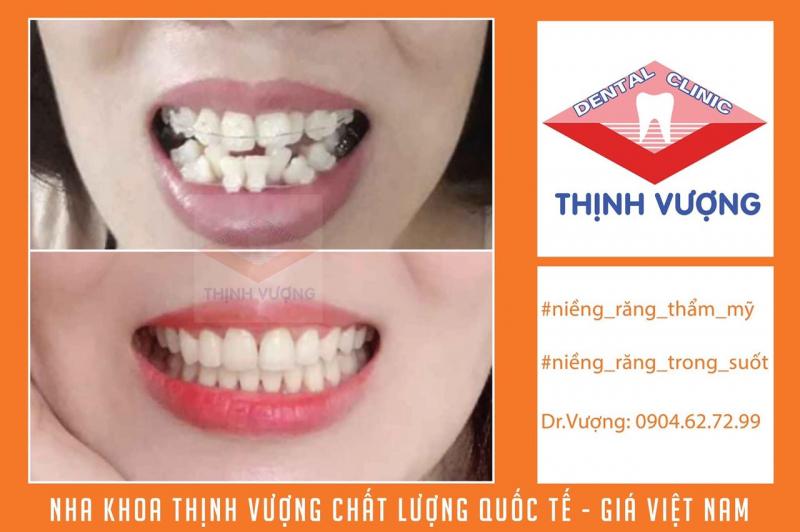 Nha Khoa Thịnh Vượng