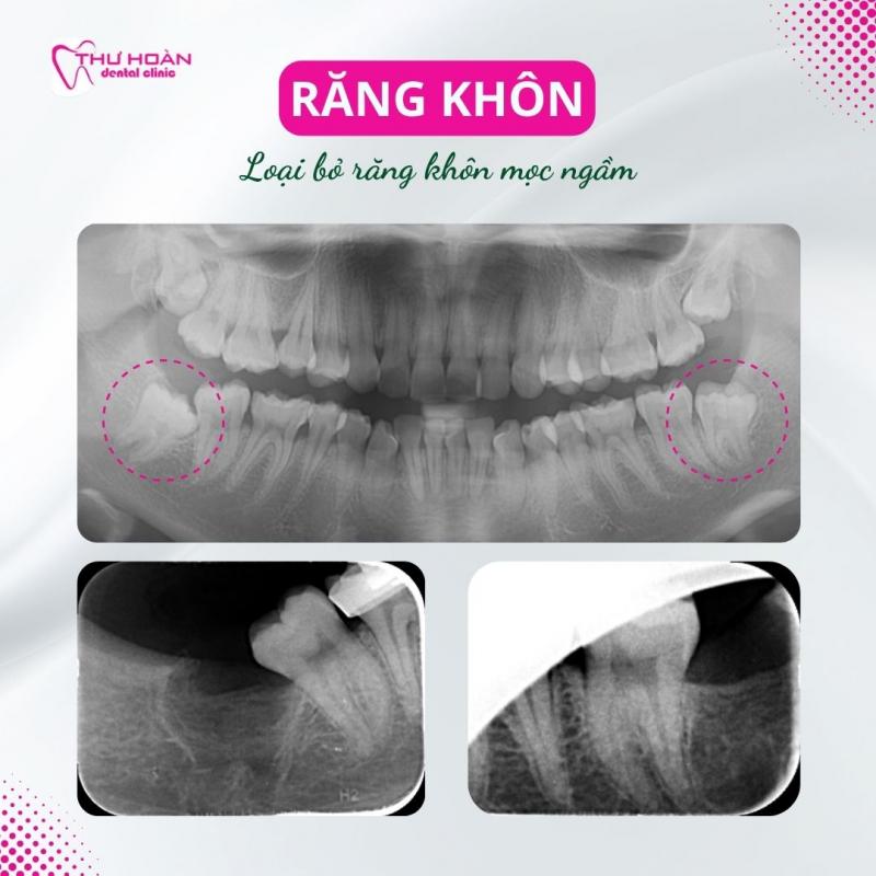 Nha Khoa Thư Hoàn - Healthy smile