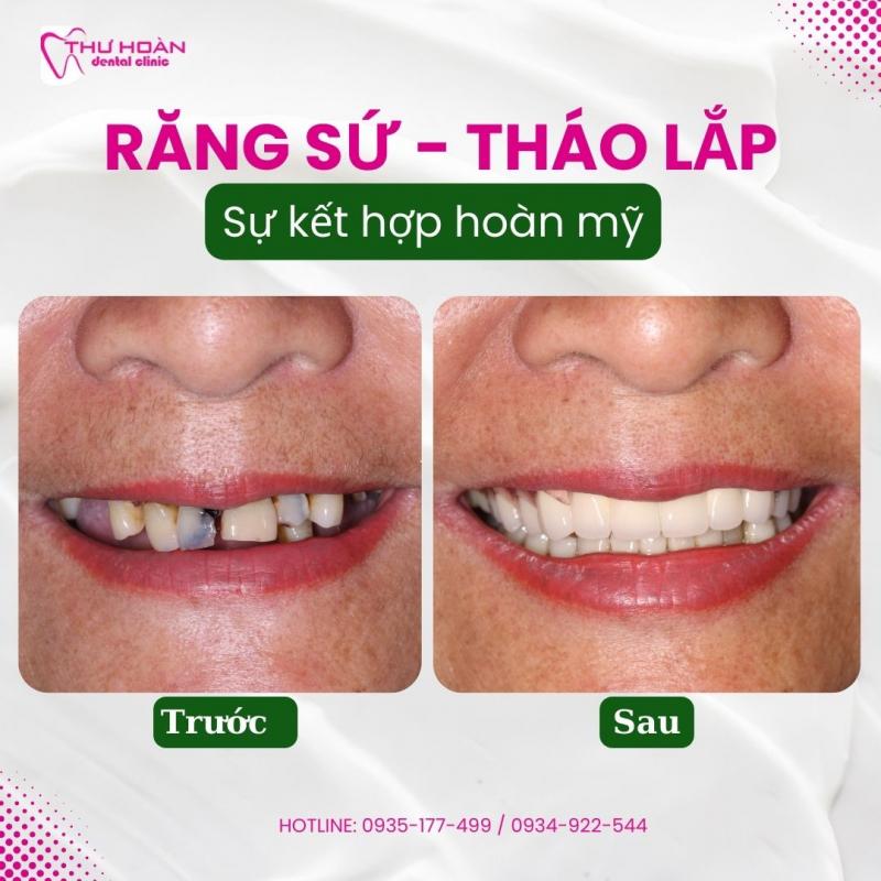 Nha Khoa Thư Hoàn - Healthy smile