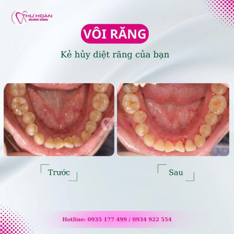 Nha Khoa Thư Hoàn - Healthy smile