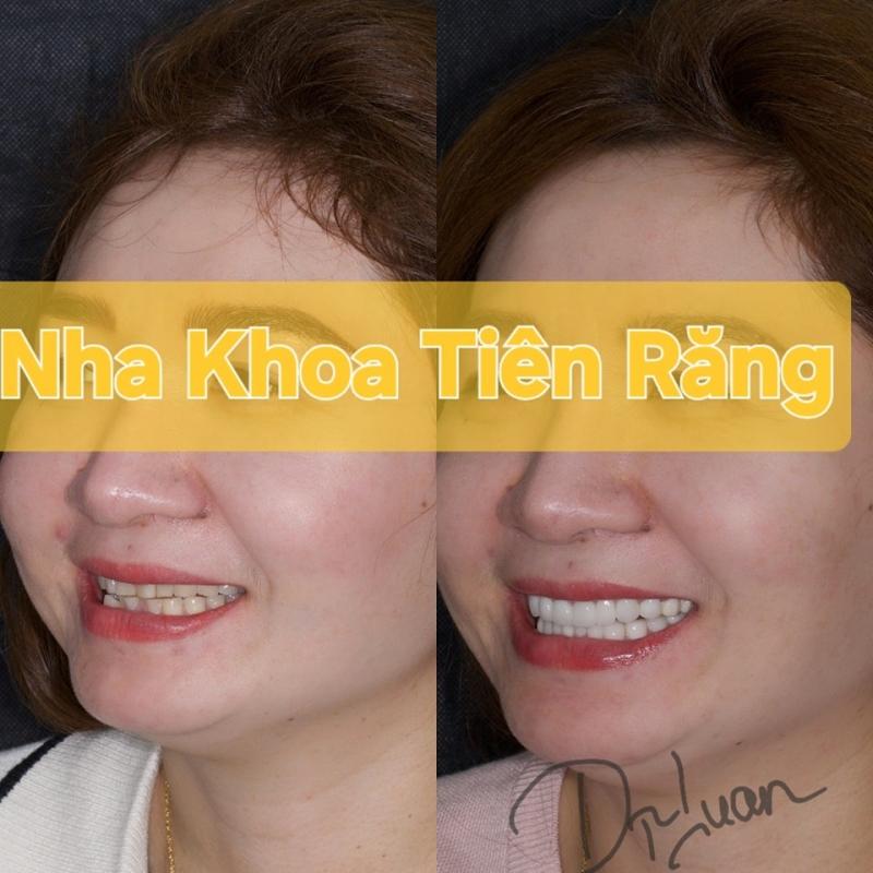 Nha Khoa Tiên Răng - Tooth Fairy Dental