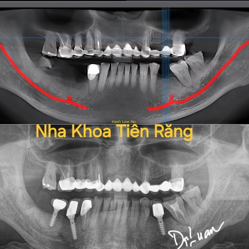 Nha Khoa Tiên Răng - Tooth Fairy Dental