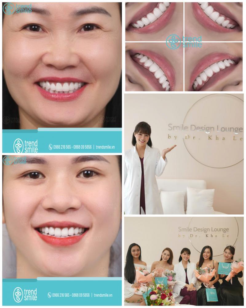 Nha khoa Trendsmile – Nơi kiến tạo nụ cười chuẩn thẩm mỹ quốc tế