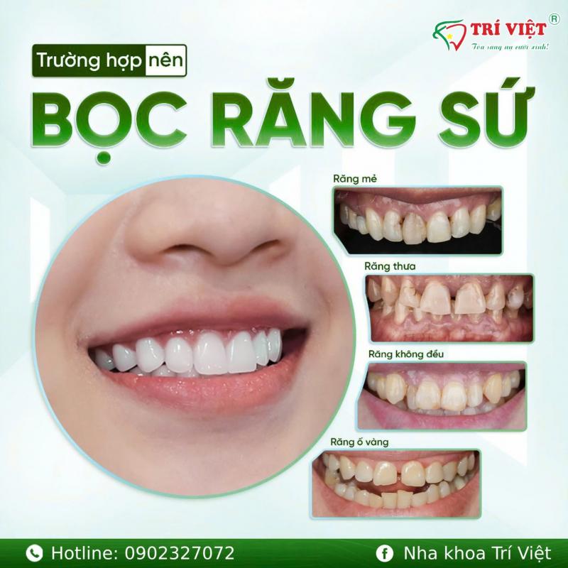 Nha Khoa Trí Việt